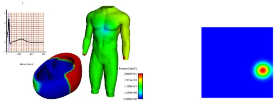 Fig. 1. Two representative pictures of the simulations run in this study. Left: heart- heart-torso coupling and Einthoven I lead ECG