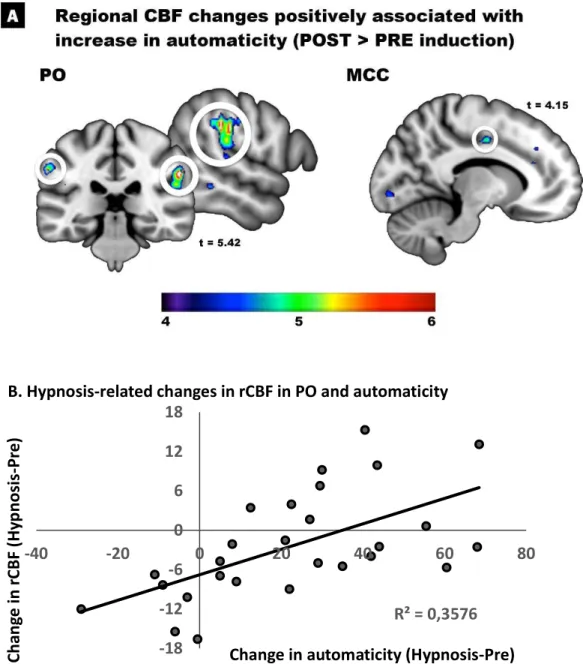Figure 3. Changes in rCBF from pre-hypnosis to hypnosis positively associated with the increase in  self-reported automaticity