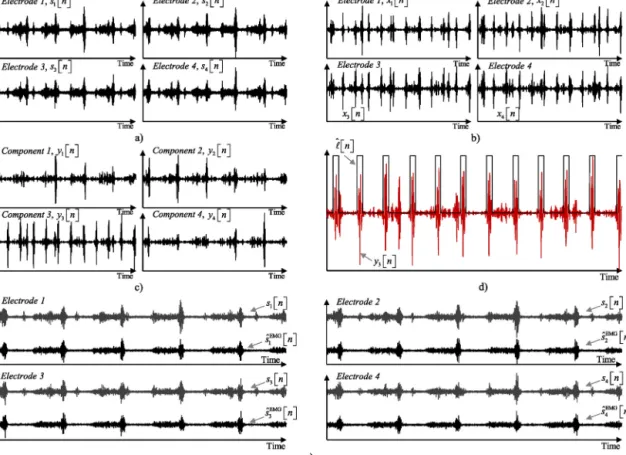 Fig. 3. Illustrations of the proposed method main steps for simulated signals with K = 4 sEMG electrodes: a) K synthetized sEMG signals with ECG for r SIR = 19 dB, b) K signals ﬁltered with the DWT, (6), c) K ICA components, (7), d) obtained cardiac pulses