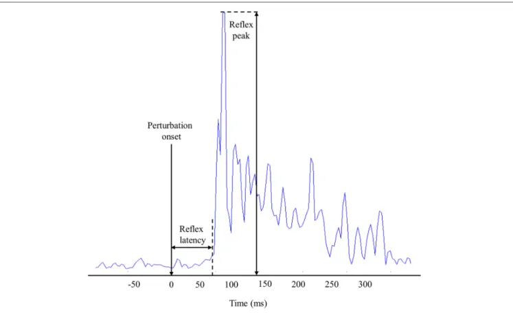 FIGURE 2 | Representation of muscle reflex variables extracted from one high-density electromyography (EMG) electrode during one perturbation trial.