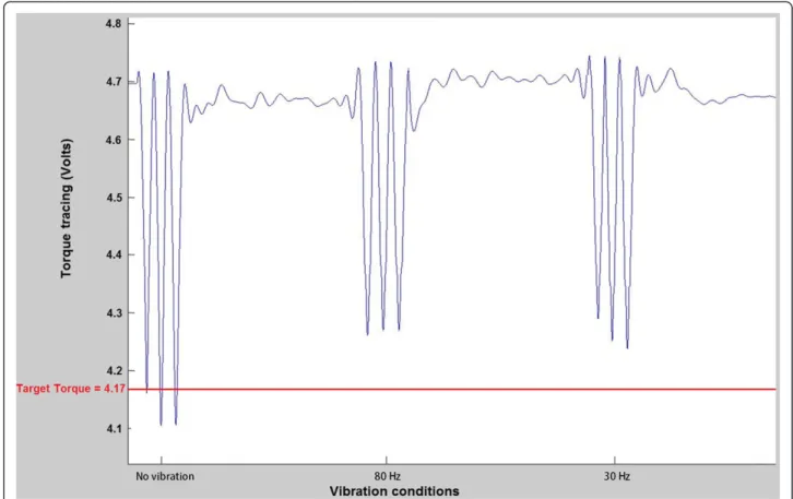 Figure 4 Example of one participant ’ s peak torque tracings in trunk extension representing one block.