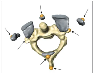 Figure 1:  Three-dimensional (3D) atlantoaxial magnetic resonance  imaging (MRI) model