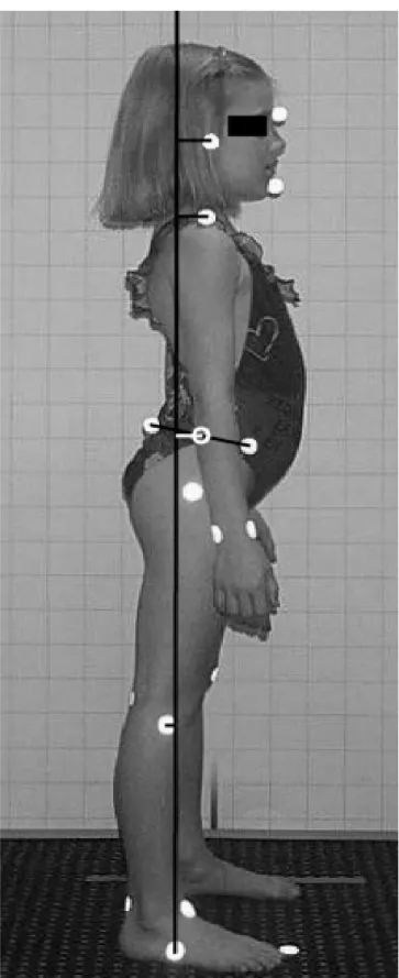 Figure 2 shows the average values and the standard devia- devia-tions for the head, shoulder, pelvis, and knee sagittal translation displacement variables with respect to age