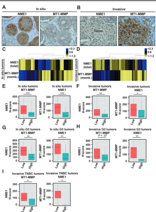 Fig. 2 Anti-correlation of NME1 and MT1-MMP cell surface levels in human breast tumors