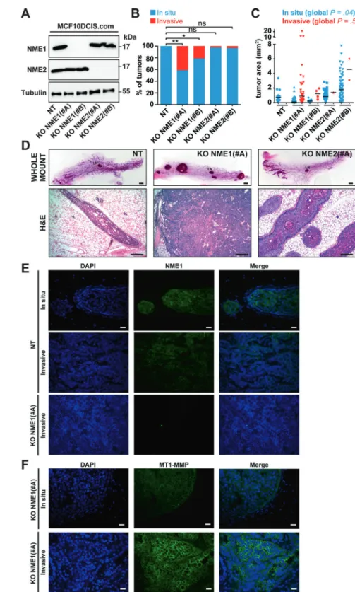 Fig. 3 Loss of NME1 function promotes the in  situ-to-invasive breast tumor transition