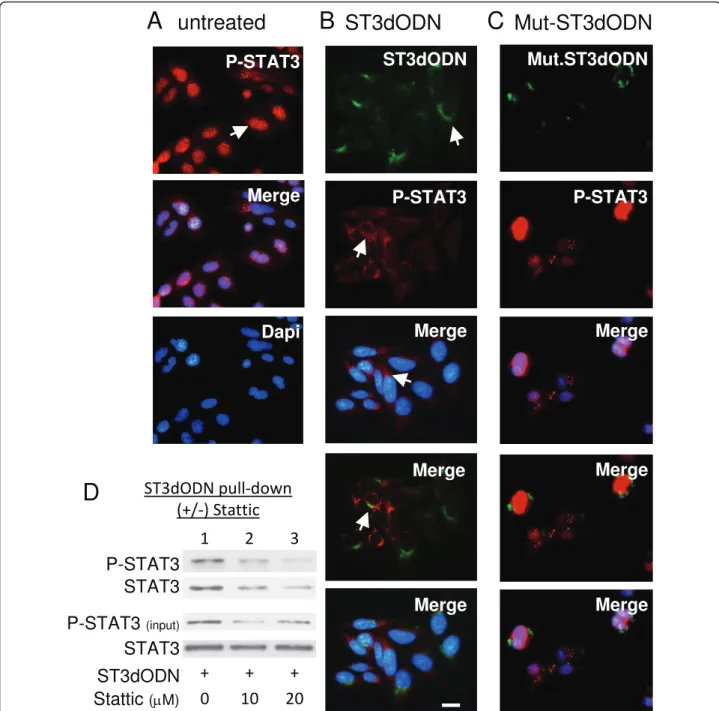 Figure 2 Inhibition of phospho-STAT3 nuclear localization by STAT3-decoy ODN. Immunofluorescence microscopy analysis: A: nuclear localization of phospho-STAT3 (red) in non-treated SW 480 cells