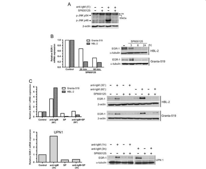 Figure 2 Basal and BCR-induced EGR-1 expressions are dependent on JNK activation. (A) Primary cells (UPN9) were pretreated with SP600125 (10 μM) for 1 hour and then stimulated with soluble anti-IgM antibody (10 μg/ml) for 5 min