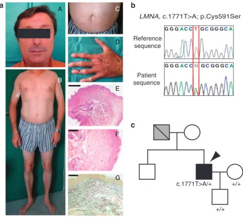 Figure 1. Clinical features and molecular characterization. (a) Clinical feature (36 years old)