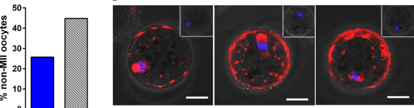 Figure 5 . Infertility of Patl2 -deficient female mice is due to oocyte maturation defects.