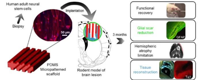 Fig 1: Neuro-implant concept. Guiding scaffolds located in a lesion of the corticospinal tract  may improve tissue reconstruction and appropriate direction of regenerated tracts