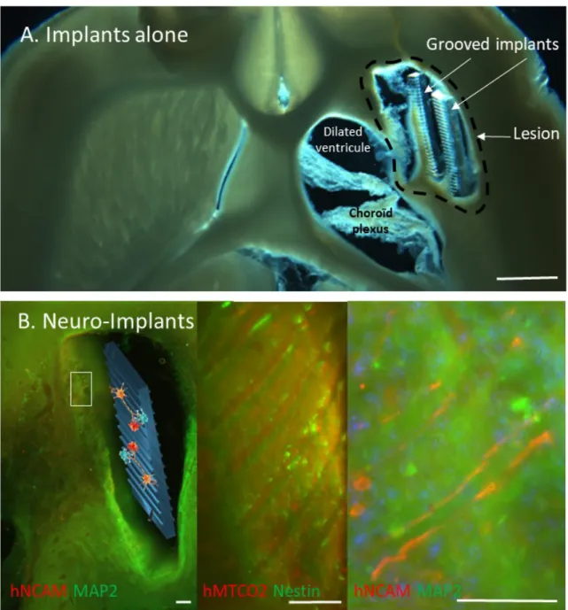 Fig.  2:  Representative  horizontal  brain  section  of  the  lesioned  area  under  brightfield  illumination  from  Implants  Alone  (A,  Scale  bar:  1  mm)  and  neuro-implants  rats  (B)