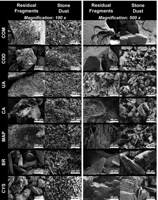 FIGURE 3 Morphological analysis by scanning electron microscopy. Each stone constituent was analyzed by SEM at magnifications of 100× and 500×.