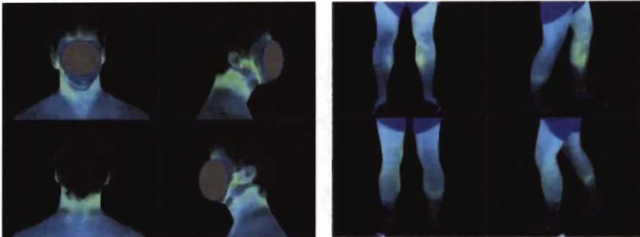 Figure  1.3  Photographies  en  ultraviolet  illustrant  le  dépôt  de  particules  fines  sur  différentes  parties  du  corps  chez  une  personne  vêtue  d'un  EPP  de  pompier  s' étant  exposée  pendant  30  minutes  en  laboratoire  à  un  environnem