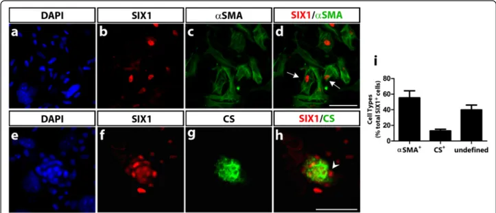 Fig. 8 SIX1 expression in cephalic NCC differentiating in culture. After 6 days of culture, cephalic quail NCC were assayed for expression of SIX1 and various NC-derived phenotypic markers (see Methods section)