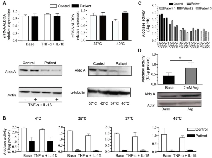 Figure 3. ALDOA expression and activity. 3A:ALDOA mRNA expression in control myoblasts (C, white bars) and the patient myoblasts (P, grey bars) under basal conditions, with TNFa+Ilb treatment (left) or at a high temperature (right, 40 u C); Aldolase A prot