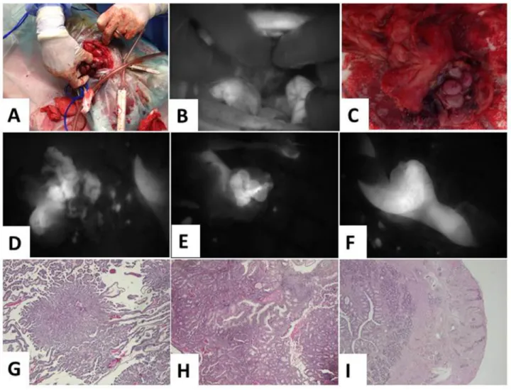 Figure 7: Angiostamp™ allowed intraoperative detection of a canine ovarian carcinoma and peritoneal carcinomatosis.