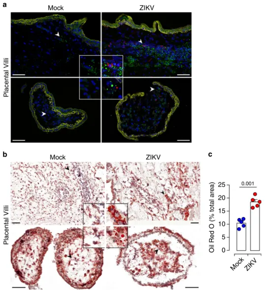 Fig. 3 Accumulation of LDs in ZIKV-infected placenta. a Representative thin sections of matched mock and ZIKV-infected placentas 5 dpi.