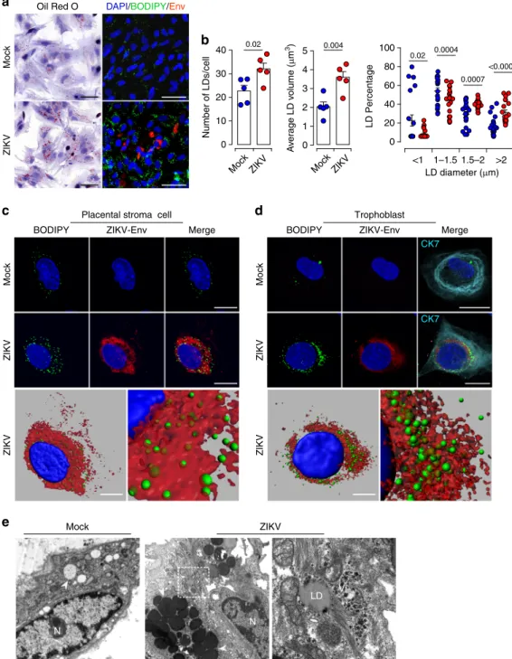 Fig. 4 Alterations of LD morphometric features by ZIKV infection of primary placental cells