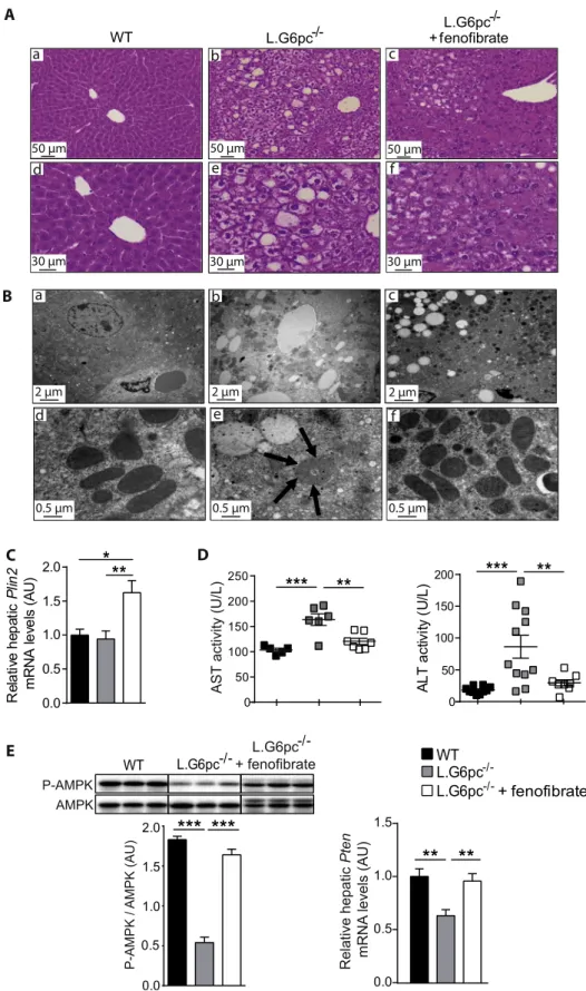 Figure 6: Liver injury is prevented by feno ﬁ brate in L.G6pc L/L mice. (A) Histological analysis of H&amp;E-staining of the livers and (B) Transmission electron microscopy analysis of hepatocytes from WT (a, d), L.G6pc  /  (b, e) and feno ﬁ brate-treated 