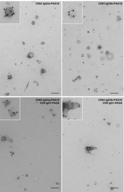 Figure 4. Immunogold labelling of extracellular vesicles with TS63a and TS63b.Top panels: TS63a or  TS63b were used to label extracellular vesicles derived from MNT-1 cells
