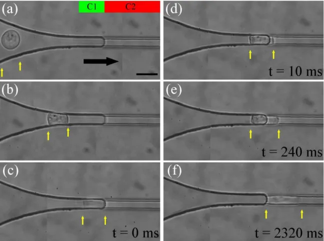Figure 2: Cell force vs. deformation experiment in a double constriction. Series of micrographs showing THP-1 cells of  diameter D i  = 17 µm (a) flowing freely with the flow in the entrance zone of C1, (b) squeezed during entry in C1, (c) stopped  in C1 a