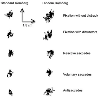 Fig. 2   Stabilogramms representing CoP displacements for one par- par-ticipant as a function of five visual tasks (fixation without and with  distractors, reactive and voluntary prosaccades, and antisaccades)  and difficulty of postural task (SR Standard 