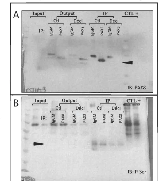 Figure 3.6  La phosphorylation sur sérine de la protéine P  AX8 est inchangée dans  les IDESC en décidualisation