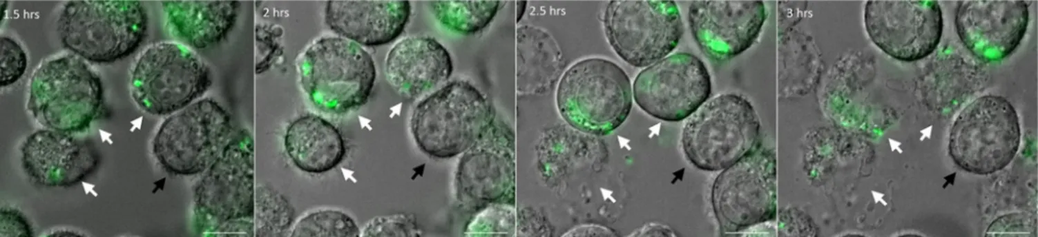 Fig 1. Live imaging of macrophages infected with P. aeruginosa. J774 macrophages were infected with PAO1 wild-type (WT) strain expressing GFP