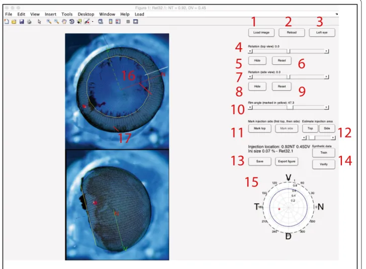 Fig. 3  Screenshot of IntactEye being used used to mark up the eye and injection. The two images have a wire-frame overlaid such that the axes  can be reconstructed