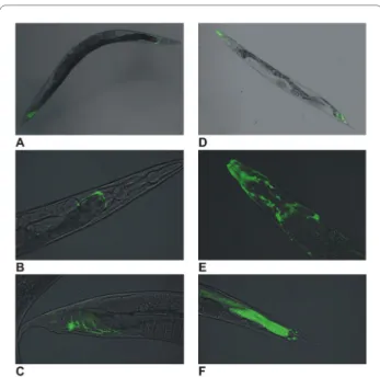 Figure 8 Expression of globinpromotor::GFP fusions. (A) glb- glb-26::GFP expression, (B) glb-glb-26::GFP expression in head mesodermal cell,  (C) glb-26::GFP expression in stomato-intestinal muscle, (D) glb-1::GFP  expression, (E) glb-1::GFP expression in 