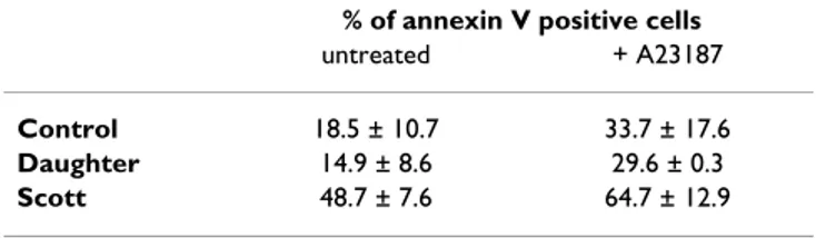 Table 1: Effect of A23187 on apoptosis. The B lymphoblasts were  cultured in basal (X-VIVO15) medium in the absence or presence  of 200 nM A23187 for 48 hours