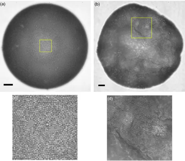 Figure 3.13: Detail of a buckling event for a bubble armored with 0.5µm particles.