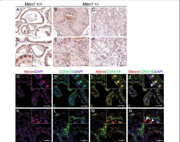 Figure 4 Reduced CDKN1B expression in prostate cancers from Men1 +/- mice. (A-F) IHC was performed on paraffin-embedded sections of prostate tissues from Men1 +/+ (A, D, n = 4) and Men1 +/- (B, E and C, F, n = 4) mice using an antibody against CDKN1B
