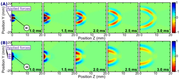 Figure 3. Normalized displacement maps along the Z axis 1.0, 1.5, 2.0, 2.5, and 3.0 ms after laser emission as produced by simulation in a 5 mm disk diameter of (A) two opposite forces along the Y axis, and (B) a force along Z axis