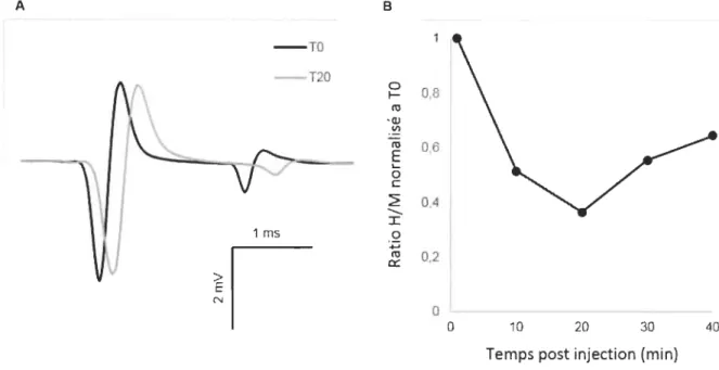 Figure 3 : Variation de l'amplitude du  réflexe-H  après injection de kétamine-xylazine 