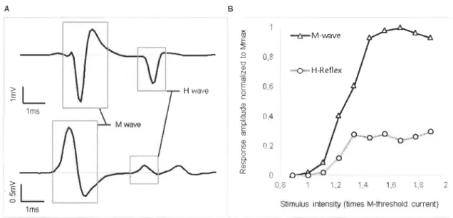 Figure 1.  Raw traces of recorded signais and  representative recruitment curve 