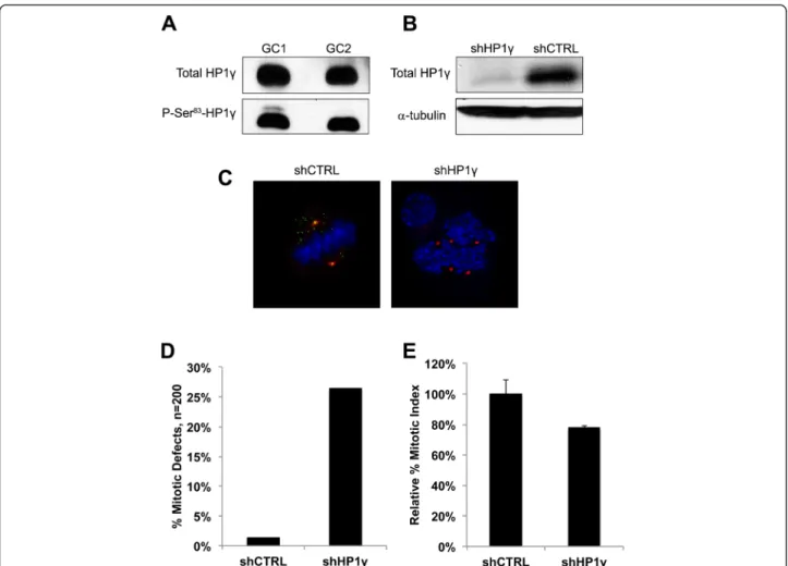 Fig. 3 Knockdown of HP1 γ in germ cells results in mitotic abnormalities. a. Levels of P-S83-HP1 γ in GC1 and GC2 cell lines