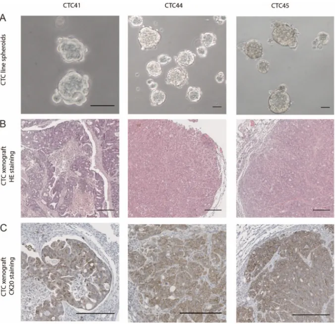 Figure 1 (A) Images of spheroids formed by circulating tumour cell (CTC)41, CTC44 and CTC45 lines (scale bar 50 μ m)