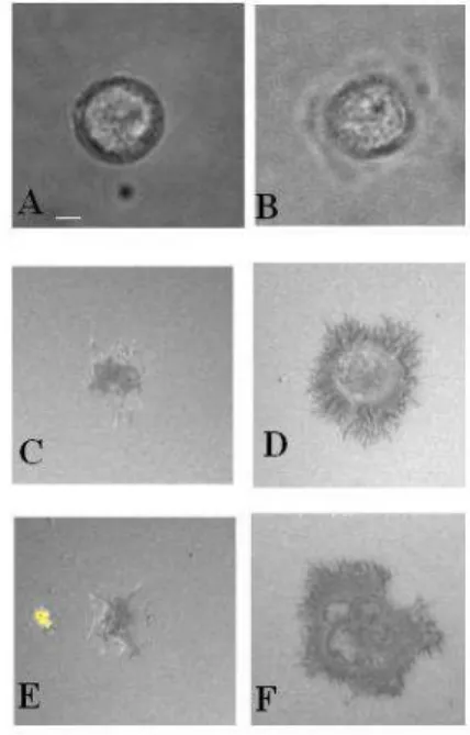 Figure  1.  Studying  the  morphology  of  cell-to- cell-to-substratum  contact  extension  with  interference  reflection  microscopy