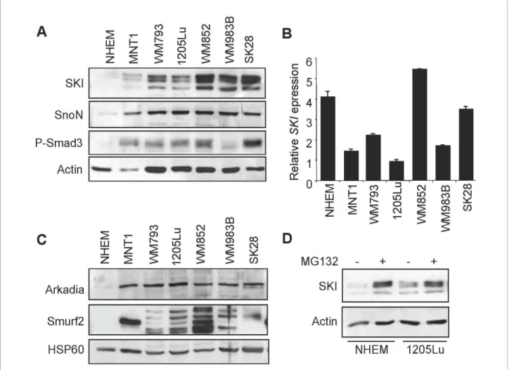 Figure 1 SKI and SnoN expression in human melanoma cell lines. A. Total protein extracts (40 μg) from unstimulated cultured melanoma cell lines and normal melanocytes were analyzed by Western blotting for SKI, SnoN and P-SMAD3 levels