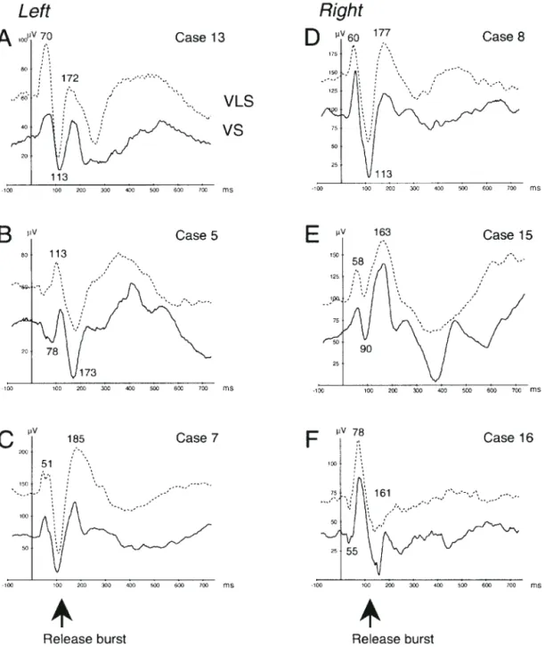 Figure 8 displays evoked responses to complex tones within the different auditory cortical areas