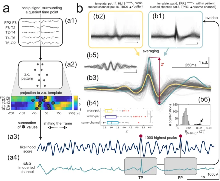Figure 3.  Detection of intracranial IEDs from scalp EEG. (a) Application of a template for intracranial IED  detection basing on scalp EEG data alone