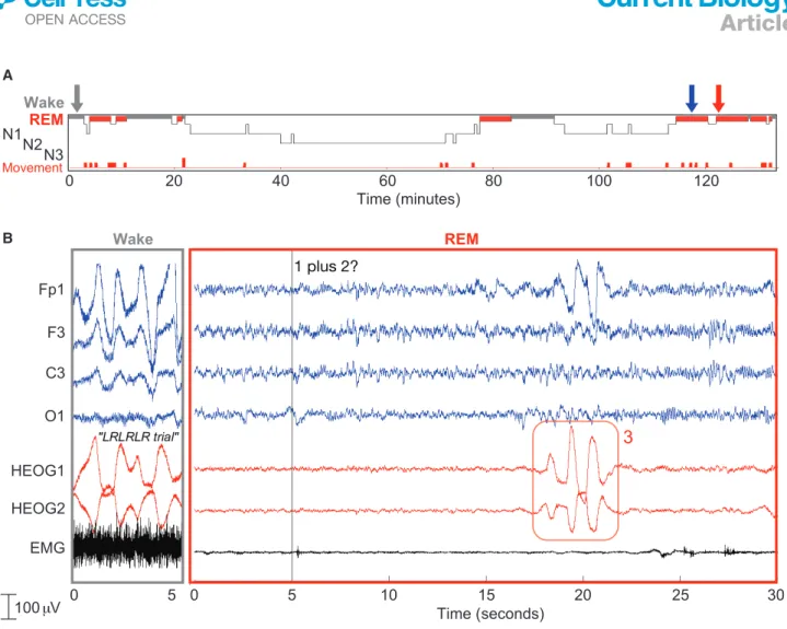 Figure 5. Interactive dreaming (Dutch group)