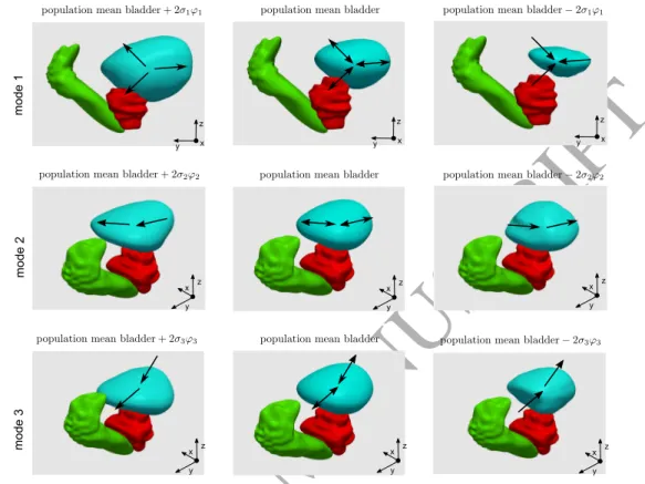 Figure 6: 3D sagittal views of the first three motion/deformation modes applied on the population mean bladder (center column)