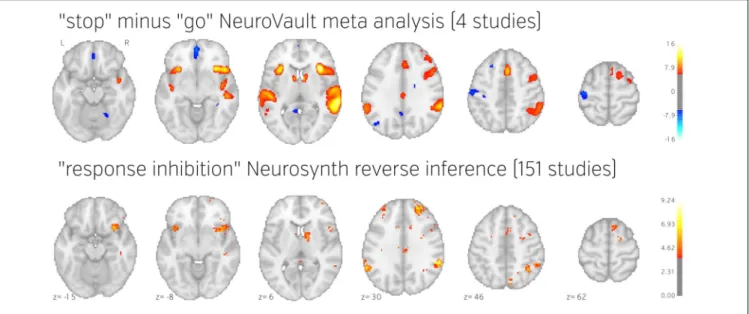 FIGURE 5 | Comparison of image based and coordinate based meta analysis of response inhibition