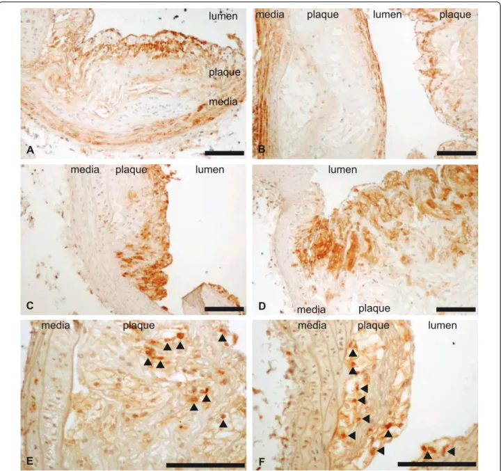 Figure 4 Immunocytology of atheroma plaques of Ldlr-/- (panels A, C, E) and Plin-/- Ldlr-/- (panels B, D, F) mice