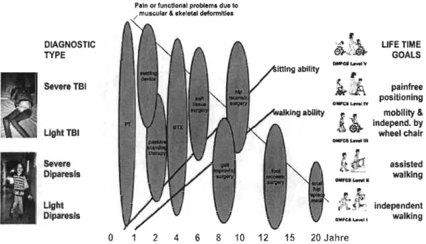 Figure 2:  Les stades de la  paralysie cérébrales (Strobl, 2012) 
