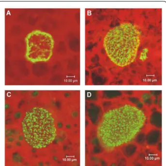 Figure 4 PfCK2 a regulation of TG2 LSA-1 cross-linking. (A) PAGE analysis of LSA-NRC incubated with PfCK2 a