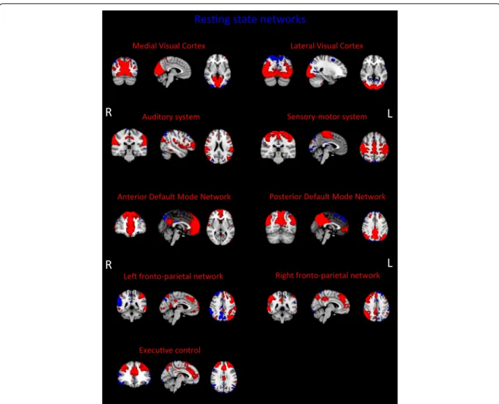 Figure 4 Resting state networks (RSNs) derived from Multiband data. Images represent group maps of 50 subjects