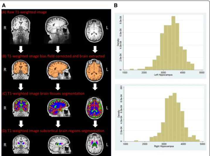 Figure 2 T1-weighted imaging – analysis pipeline and initial volumetric results. A. Schematic figure representing the pipeline set up to analyse T1-weighted images